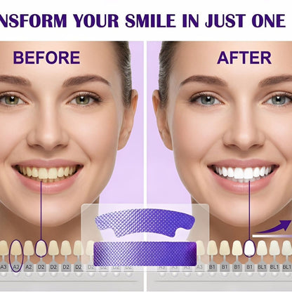 GNYS Purple teeth whitening strips